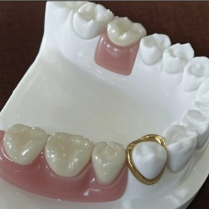 Attacco di precisione